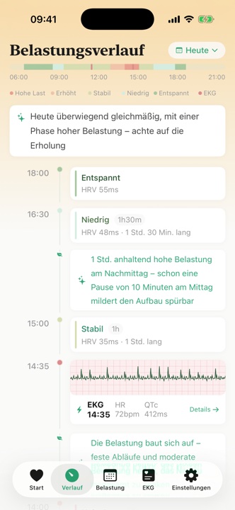 Belastungsverlauf mit EKG-Aufzeichnungen
