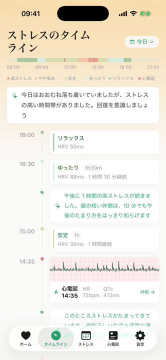 心電図の記録が並ぶストレスのタイムライン