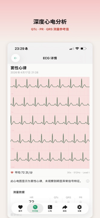 心电详情与间期测量